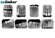 Resolusi 17 Lp / Mm Dental Intraoral Scanner 14 Bit Tingkat Abu-abu Ukuran Kecil