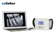 Medis Oral 20KHz LCD 7800mAh 80W Unit X-Ray Gigi